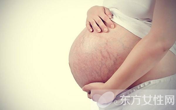 產(chǎn)后如何去掉妊娠紋 這些錯誤方法趕緊改過來