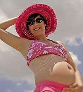 孕期皮膚粗糙敏感 孕婦如何護(hù)理皮膚