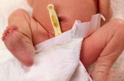 初生嬰兒臍帶護(hù)理方法 出現(xiàn)這些情況應(yīng)及時(shí)就醫(yī)
