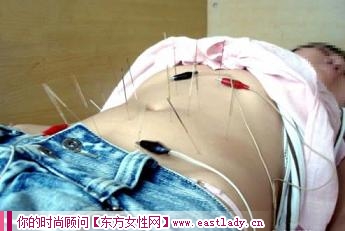 針灸治療中應(yīng)注意的問(wèn)題