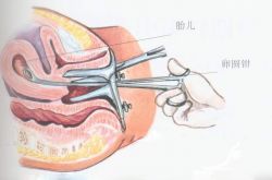 人工流產(chǎn)的最佳時(shí)間 人流后多久可以要小孩呢