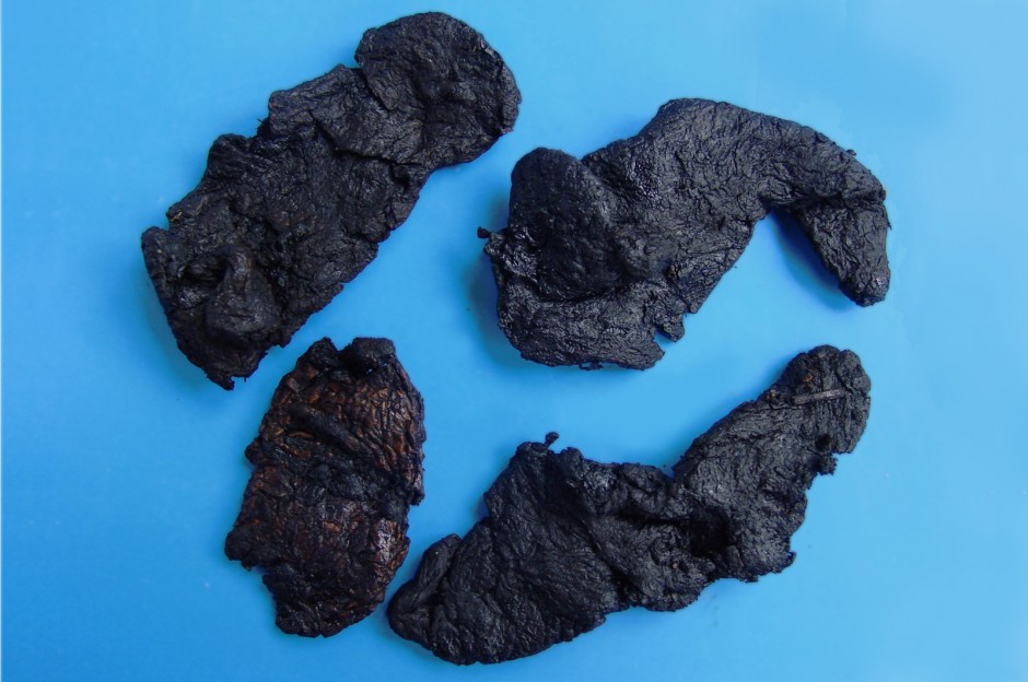 女性什么年齡閉經(jīng) 6種閉經(jīng)類型調(diào)理偏方