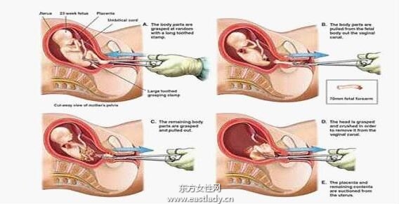 流產(chǎn)后吃什么好 這些流產(chǎn)后調(diào)養(yǎng)千萬別忽略