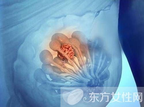 小葉增生癥狀是怎么樣的 引起小葉增生的原因有哪些