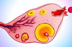 多囊卵巢綜合癥是怎么引起的 這么做可以有效預(yù)防哦