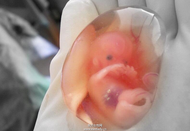 流產(chǎn)后吃什么好 這些流產(chǎn)后調(diào)養(yǎng)千萬別忽略