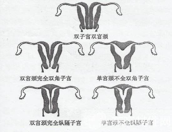 子宮發(fā)育不良的癥狀表現(xiàn) 子宮異常的危害居然這么大